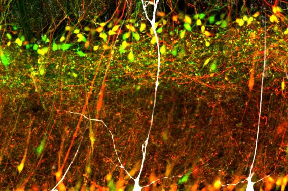Hippocampal Neurons