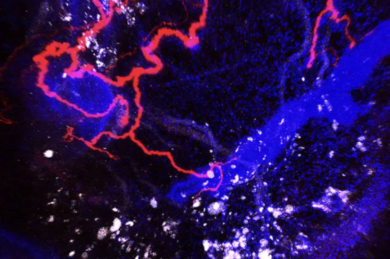 Nerves (in red) embedded in the breast tumor (white) of a mouse. Dr Yue (May) Wu