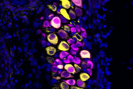 Microscope image of sensory neuron ganglia shown in yellow and magenta
