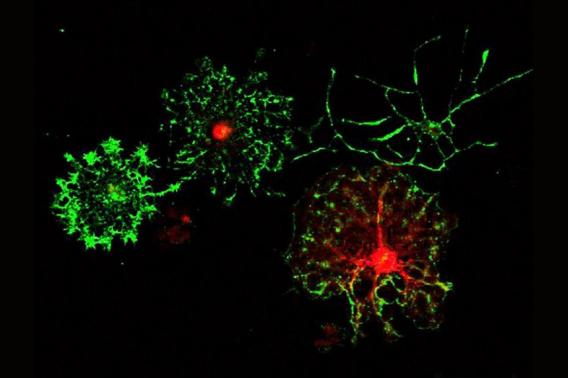 Oligodendrocyte precursor cells (OPCs) that the Gibson lab cultures in vitro and differentiates into myelinating oligodendrocytes.