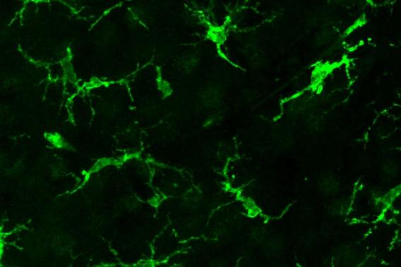 A microscope image of microglia in green.