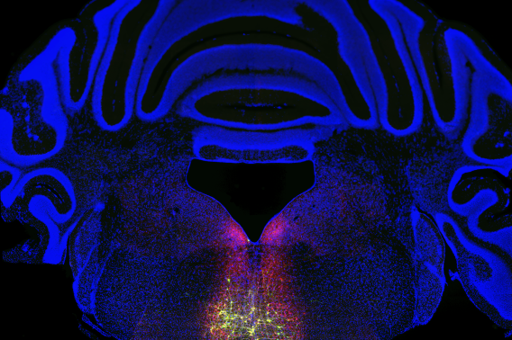 Blue folds wrap around a central region with red and yellow dots, outlining neurons in the brain.