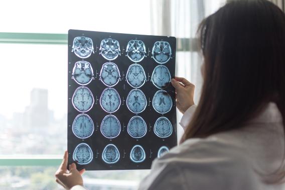 A woman in a white coat examines medical images of the brain.