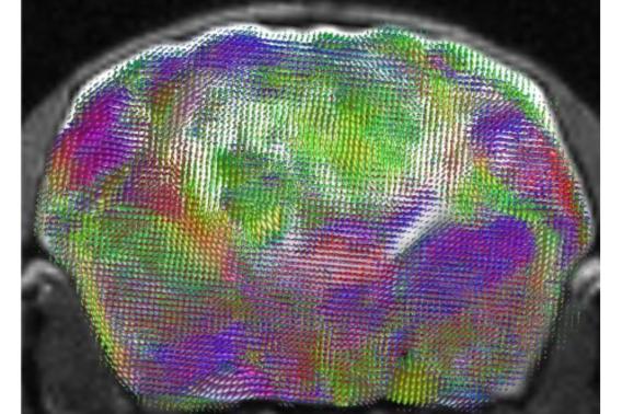 A multicolored MRI image of a xenocortical mouse brain