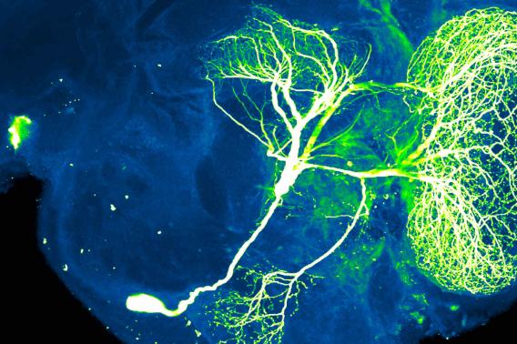 Neurons in insect brain