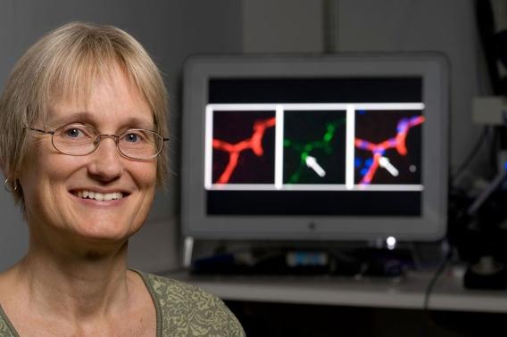 Katrin Andreasson immune cells as driver of mental aging