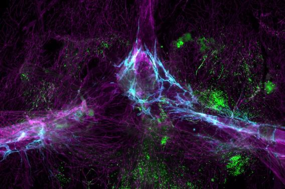 grey matter and brain's immune system