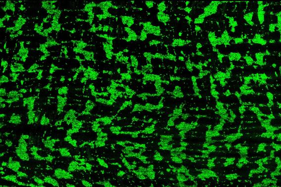 Neuronal grid in the human duodenum at 19 gestational weeks