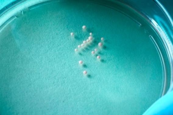 3-D brain cultures in a lab dish