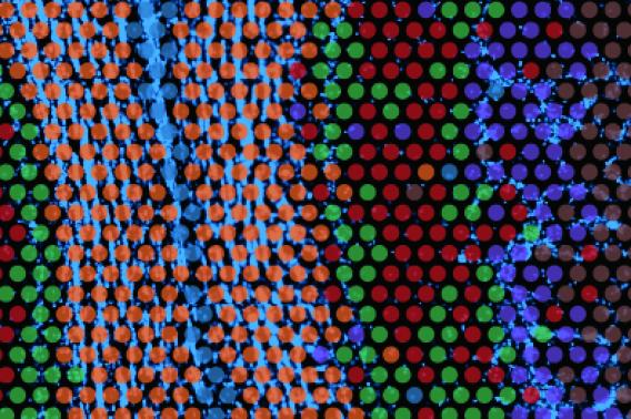 Ex-ST method is overlaid on tissue from the olfactory bulb