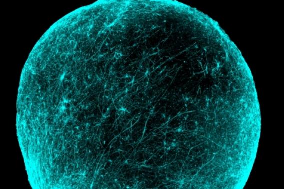 neuronal clusters to understand schizophrenia