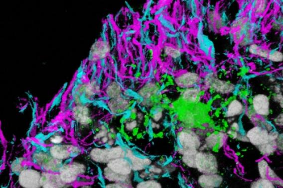 three different brain-cell types