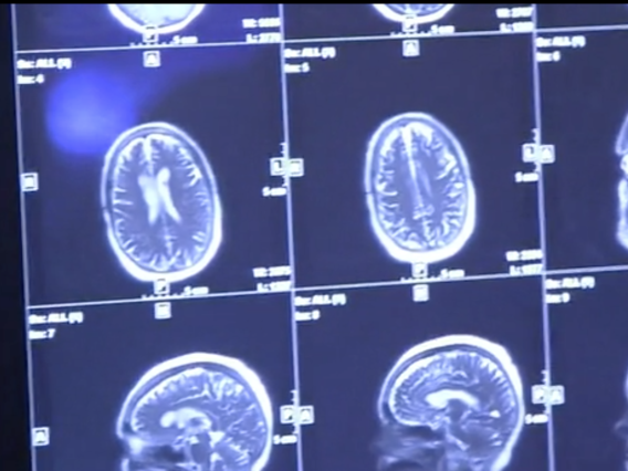 MRI brain scans, Wu Tsai Neurosciences Institute, NeuroHealth