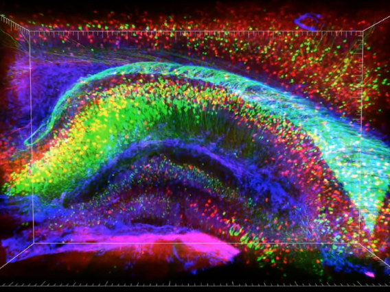 Colorful brain image, Wu Tsai Neurosciences Institute, NeuroDiscovery
