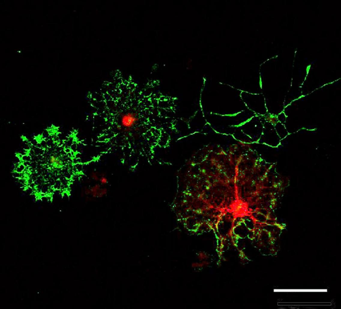 Oligodendrocyte precursor cells (OPCs) that the Gibson lab cultures in vitro and differentiates into myelinating oligodendrocytes. Image by Erin Gibson.
