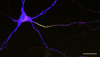 A mouse neuron highlighting axon initial segment in yellow