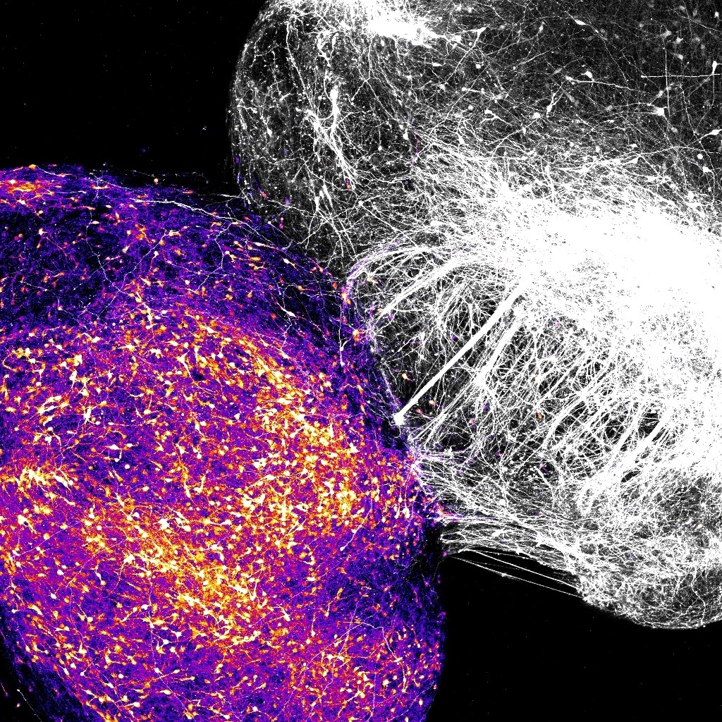 Neural organoids representing striatum and cortex merge in a laboratory dish, enabling scientists to study the rules governing the growth of human brain circuits.
