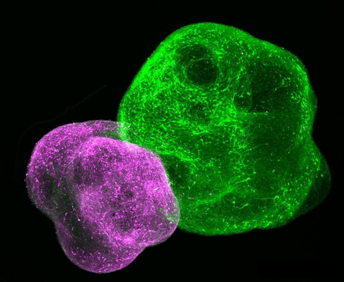 Lab-grown neuronal organoids allow scientists to study how different parts of the developing brain wire together. Image credit: Pasca Lab